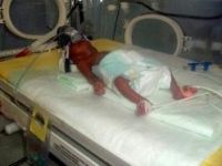 12 gün önce dünyaya gelen 560 gramlık parmak bebek hayata tutundu