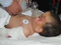 Üçüncü kattan düşen minik Kerem, yoğun bakımdan çıktı